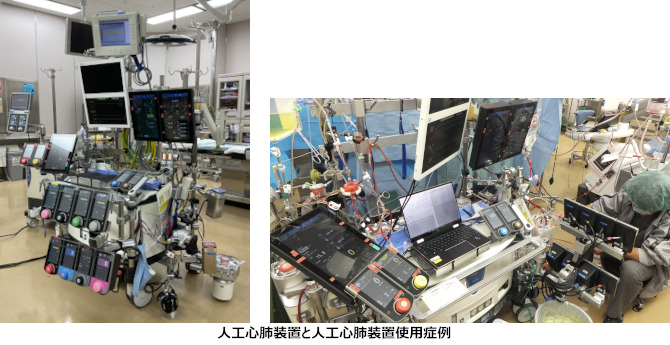人工心肺関連業務