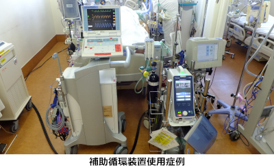 補助循環関連業務